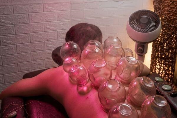 Fire Cupping Therapy in Bali
